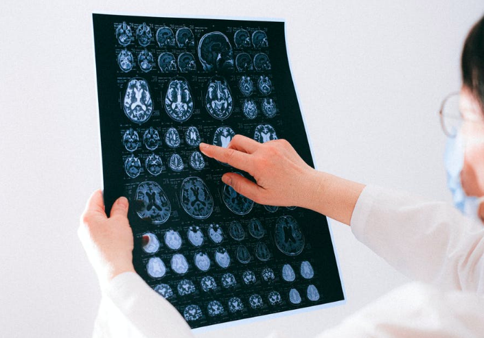 woman pointing at brain scan